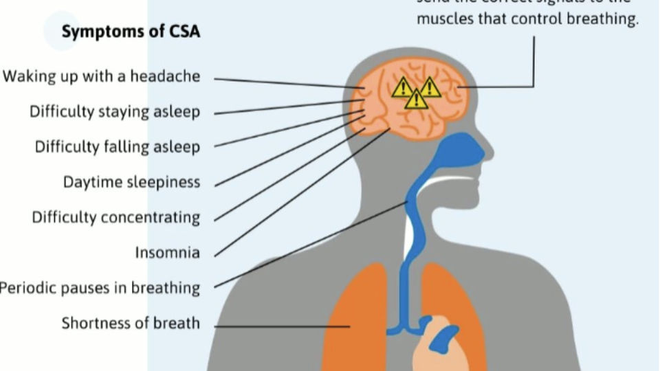 What is Central Sleep Apnea